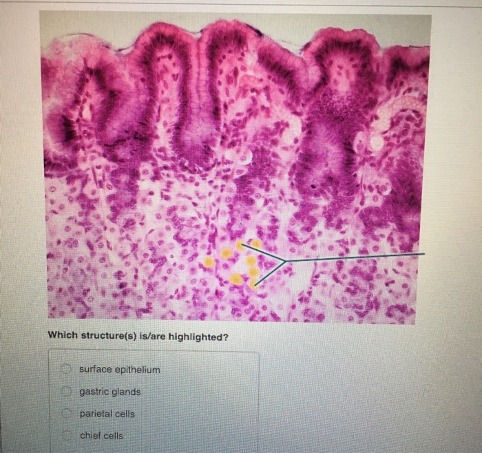 Half head musculature highlighted structure scientific lt lymphatic considered part transcribed text show both