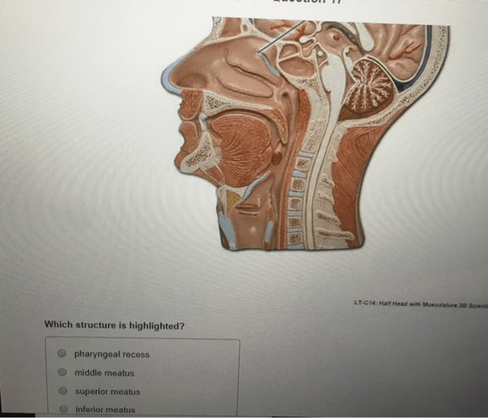 Lt c14 half head with musculature labeled