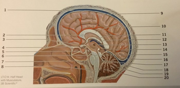 Lt c14 half head with musculature labeled